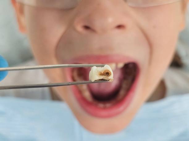 Best Emergency Treatment for Jaw Pain or Injury in Columbus, NE